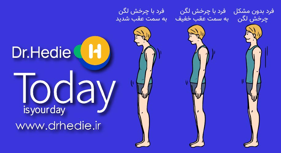 چرخش لگن به عقب